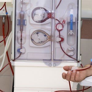 Dialysis machine